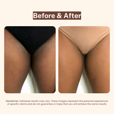 Bikini Line Aftercare Serum
