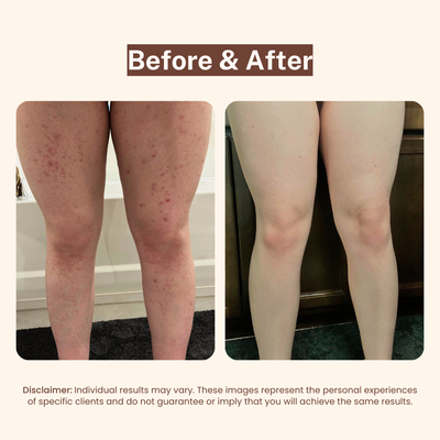 Bikini Line Aftercare Serum
