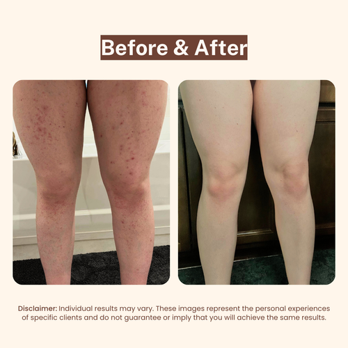 Bikini Line Aftercare Serum