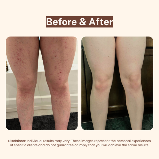Bikini Line Aftercare Serum